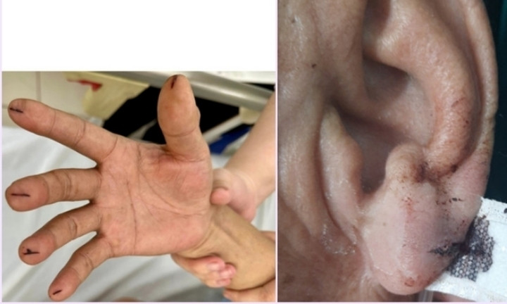 Nhiều trường hợp