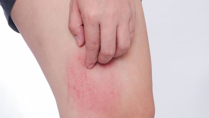 Dù là nam hay nữ nếu 3 vị trí này trên cơ thể ngứa ngáy rất có thể bạn đã mắc phải bệnh lây truyền qua đường tình dục