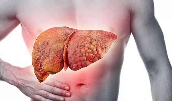 Ung thư gia tăng nồi cơm điện là đồng phạm Cảnh báo 6 thói quen phổ biến này mới thực sự gây ung thư