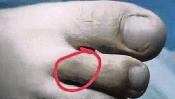 Đi bộ về khách sạn, cô gái 27 tuổi bị rắn cắn tử vong- Ảnh 2.