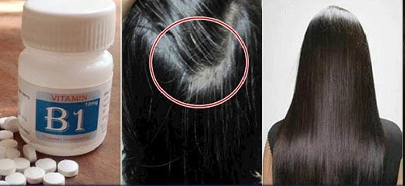 Loại vitamin tác dụng thần kỳ đối với tóc, giúp tóc bóng khỏe, dài nhanh- Ảnh 2.