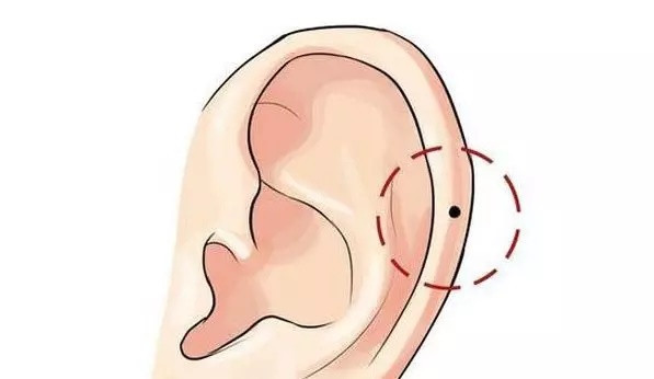 Bí mật thú vị về nốt ruồi trên tai Bất ngờ số 2 khiến ai cũng giật mình