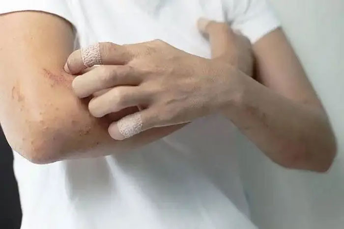 Bác sĩ phát hiện Dấu hiệu sớm của tiểu đường không phải khát nước mà là 3 triệu chứng này biết sớm để giảm rủi ro