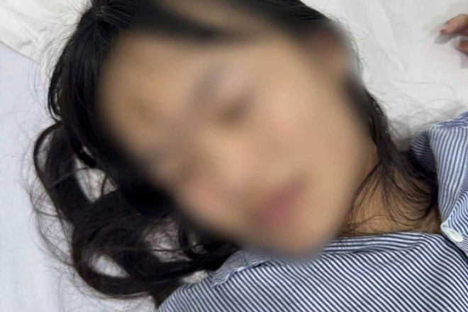 Nữ sinh lớp 8 nhập viện nghi do bị bạn đánh hội đồng- Ảnh 1.