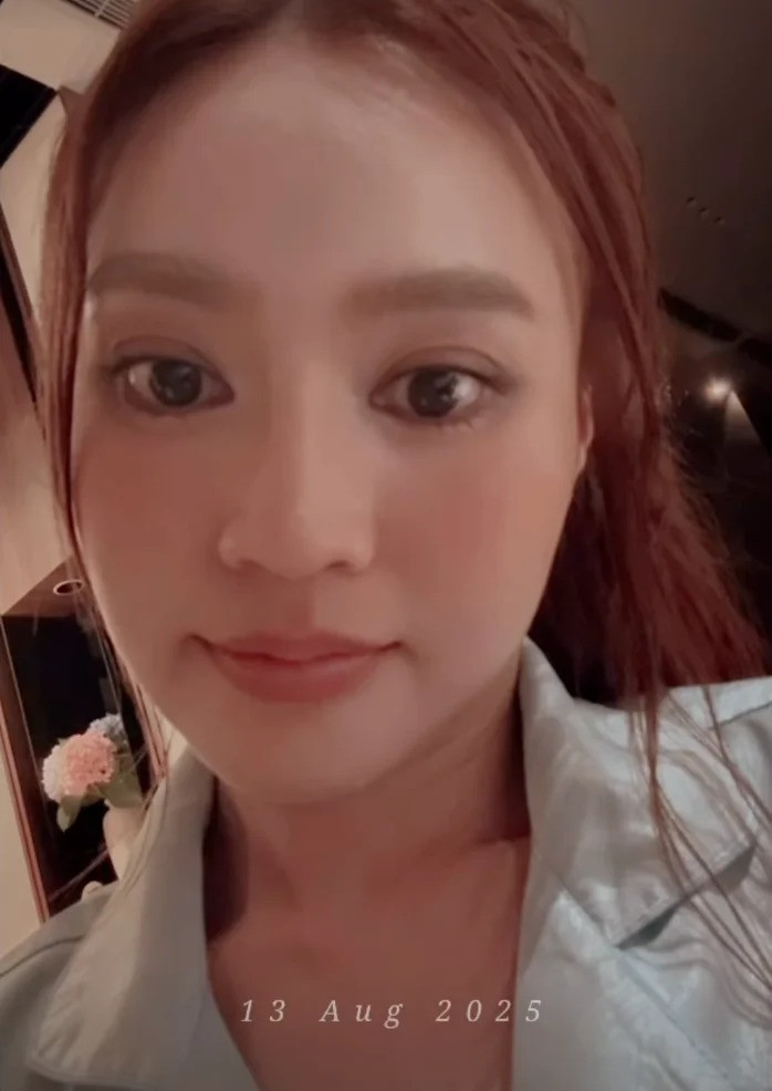 Tình hình hiện tại của Ninh Dương Lan Ngọc sau chấn thương ngồi xe lăn