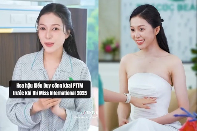 Hoa hậu nối gót Thanh Thủy thi Miss International 2025 Sắc mờ nhạt lộ khuyết điểm lớn qua cam thường