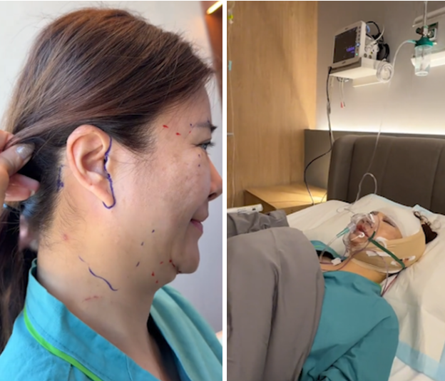 Không nhận ra diễn viên đanh đá nhất Việt Nam hậu sang Hàn trùng tu toàn bộ gương mặt