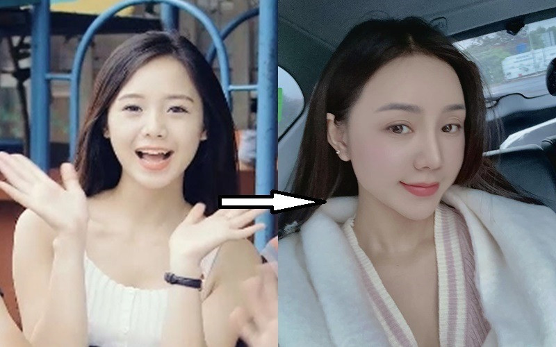 Quỳnh Kool đáp trả gắt khi bị chê mặt đơ búng ra filler ngày càng khác lạ vì thẩm mỹ