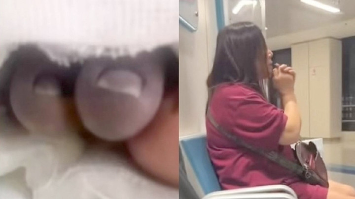 Bé trai 2 tuổi bất ngờ phát sốt, nguy cơ cắt bỏ bàn chân sau khi theo bà đi chợ - Ảnh 1.