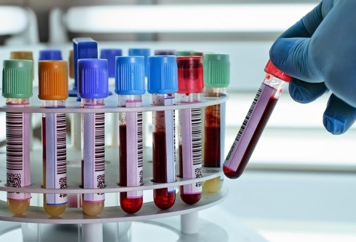 Nhân viên y tế lấy máu xét nghiệm. (Ảnh minh hoạ)