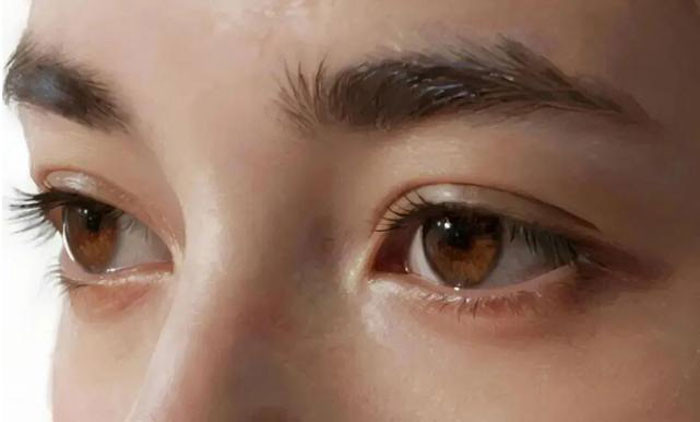 Bốn thay đổi ở mắt này có khả năng là ung thư vì vậy đừng xem nhẹ