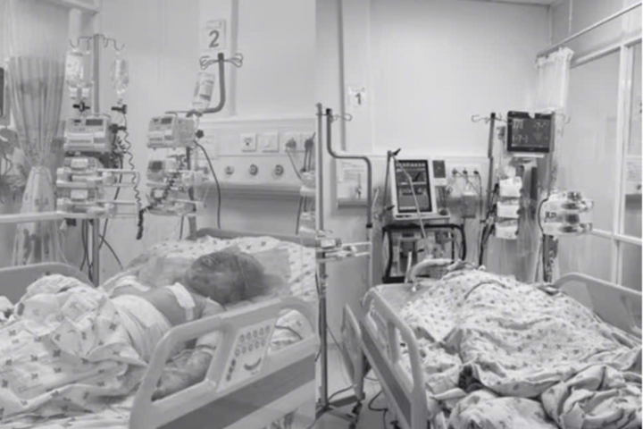 Hai cháu nhỏ con Đ. đang được điều trị tích cực tại Bệnh viện Nhi đồng Thành phố.