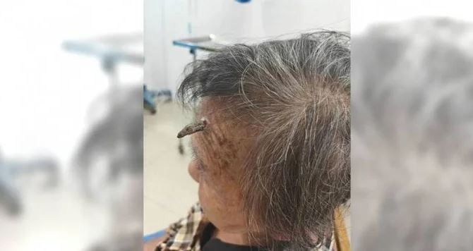 Cụ bà 98 tuổi bất ngờ