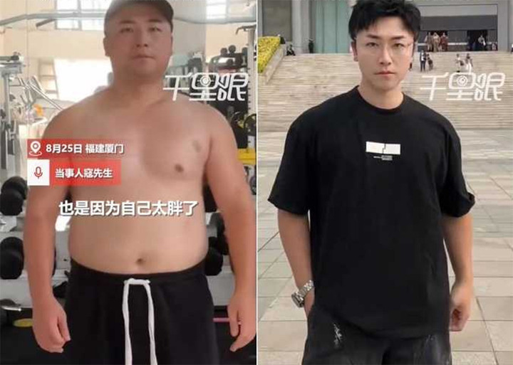 Tiểu Khẩu đã giảm 35kg trong ba tháng. (Ảnh: Sohu)