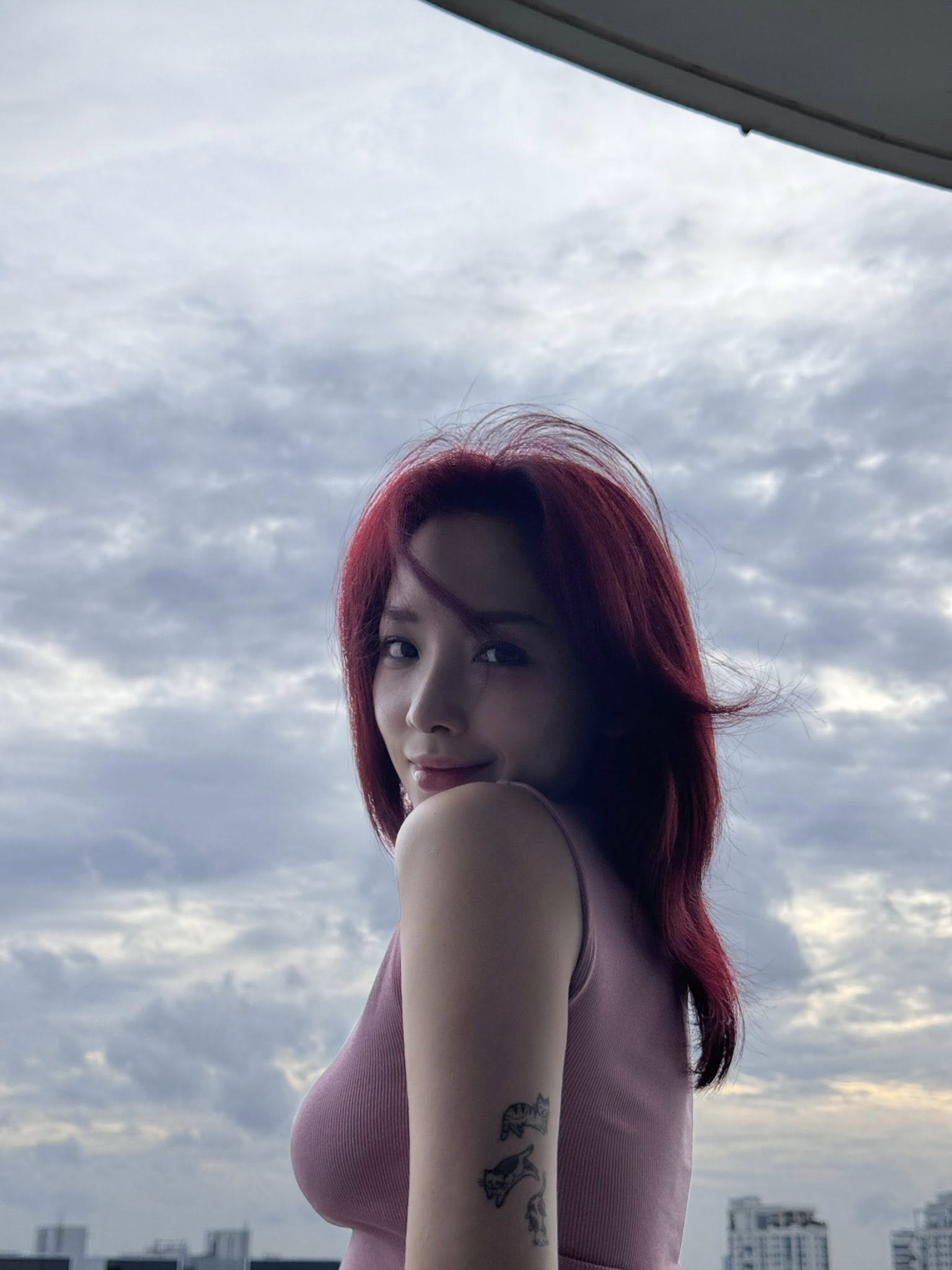 Tóc Tiên vừa phẫu thuật thẩm mỹ