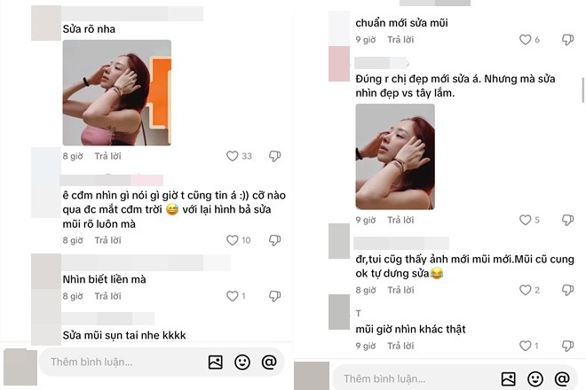 Tóc Tiên vừa phẫu thuật thẩm mỹ