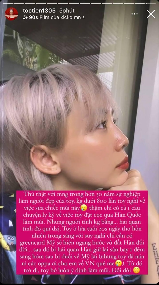 Tóc Tiên vừa phẫu thuật thẩm mỹ