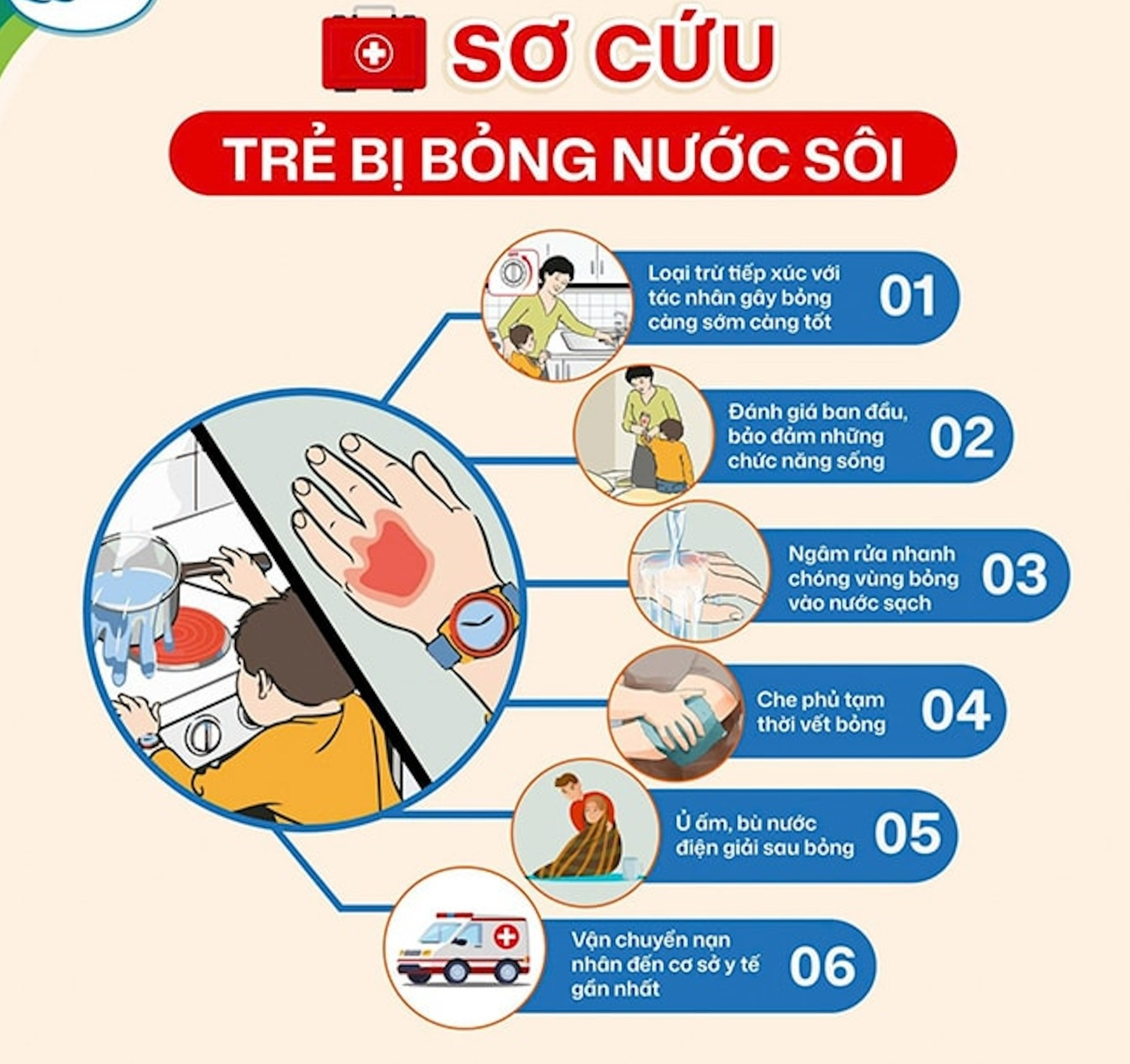 Be bi bong nuoc lau_44.jpg