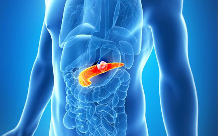 4 dấu hiệu bất thường cảnh giác với ung thư tuyến tụy