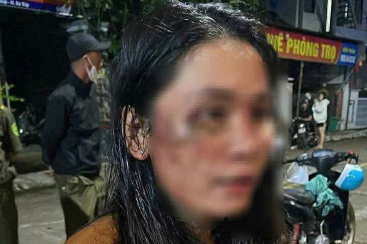 Chị H. tố bị khách hành hung đến nhập viện (Ảnh: H.T)