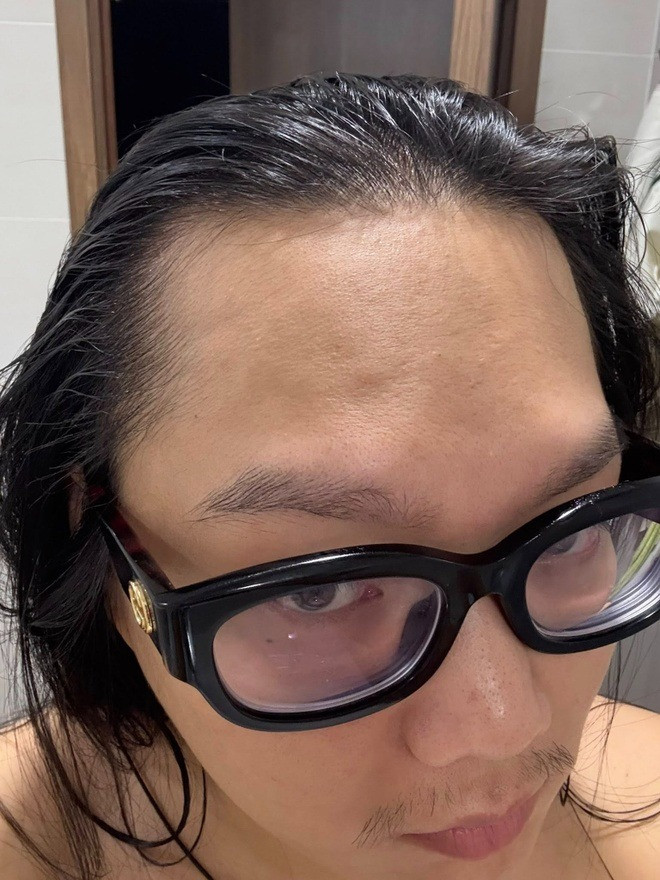 Tình trạng khó khăn sức khỏe đáng báo động của Phạm Thoại