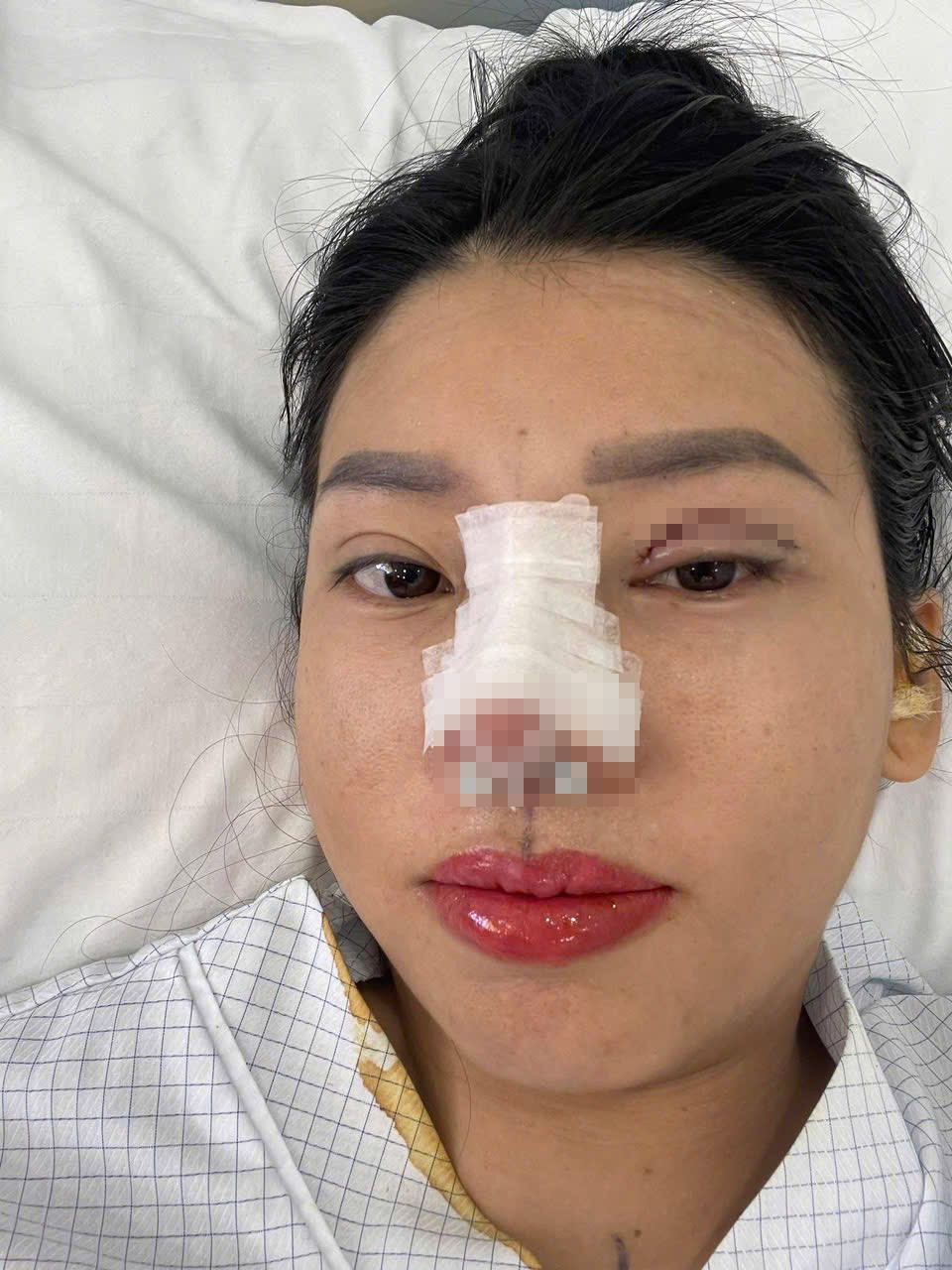 Thị Nở tái sinh Quách Phượng tiếp tục phẫu thuật thẩm mỹ diện mạo mới gây bất ngờ