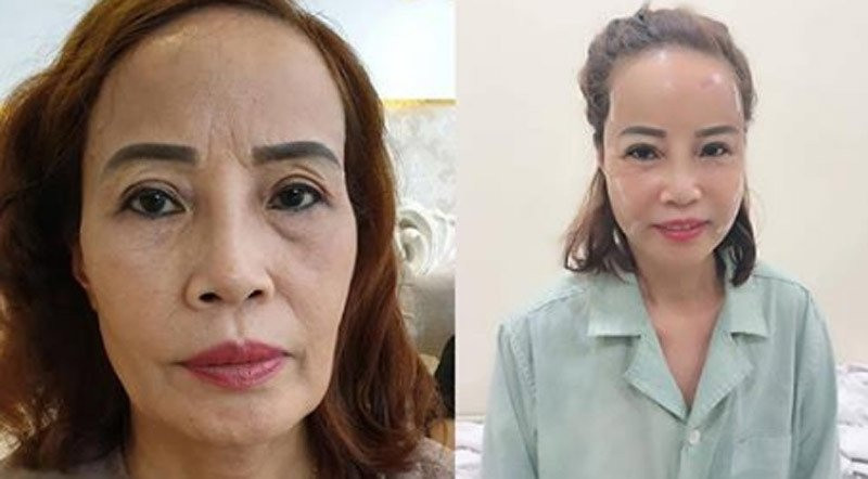 Diện mạo khác lạ của chồng trẻ kém 36 tuổi sau nghi vấn ly hôn cô dâu Cao Bằng
