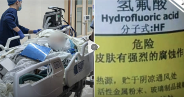 Người phụ nữ giẫm phải