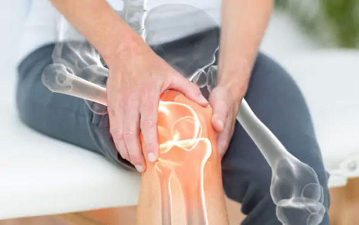 Loãng xương không phải do uống ít sữa 8 loại thực phẩm ăn cắp canxi hãy cẩn thận với xương giòn