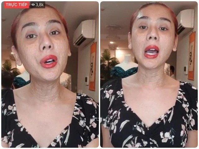 Cận gương mặt Lâm Khánh Chi sau khi sang Thượng Hải đại trùng tu nhan sắc lần n