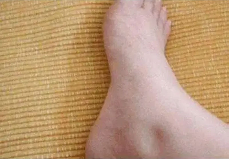 Dưỡng gan 3 món ngọt cần tránh 2 vị đắng nên tăng cường