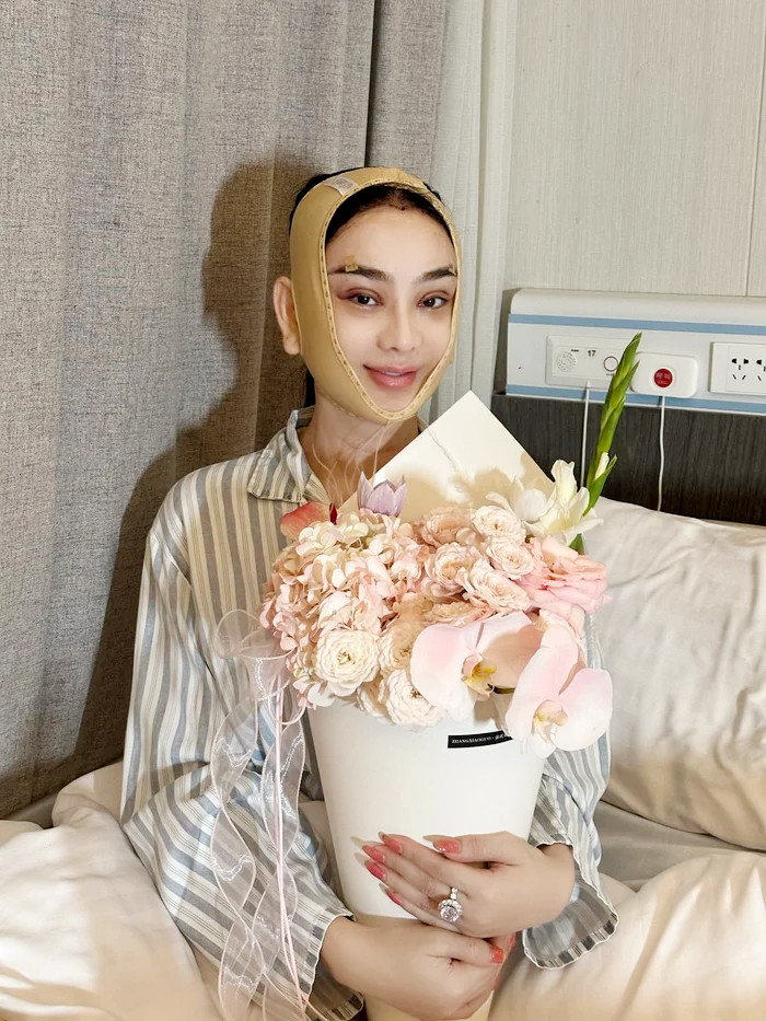 Nhan sắc Lâm Khánh Chi sau 10 ngày tiếp tục can thiệp