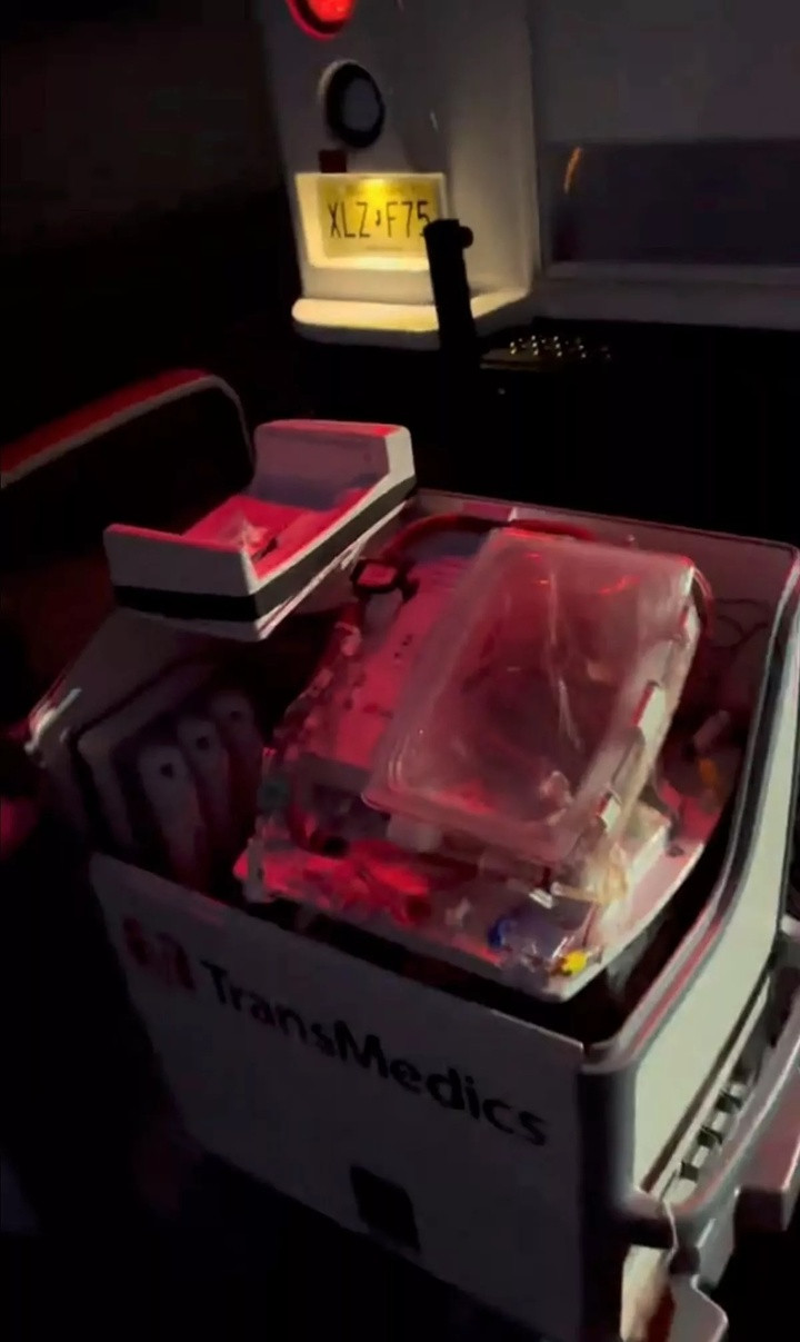 Trái tim đang đập trong thiết bị ý tế. (Ảnh: TikTok/@julio.24g)