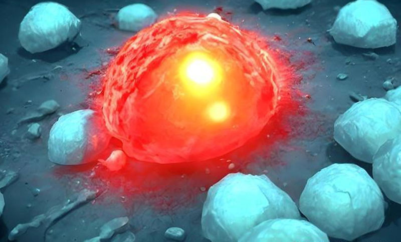 Có khối u ác tính hay không Bạn có thể nhận biết bằng cách quan sát phần thân dưới