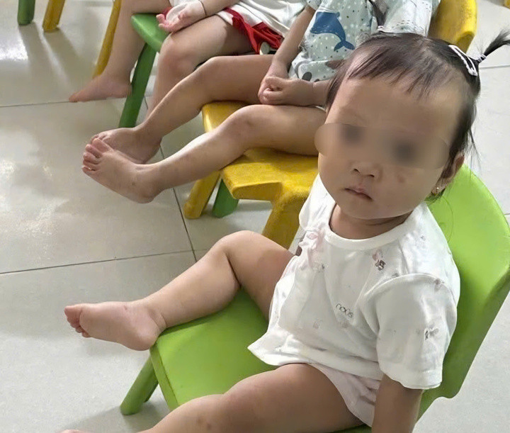 Hiện sức khỏe cháu D.T.V đã khỏe mạnh, vui chơi cùng gia đình