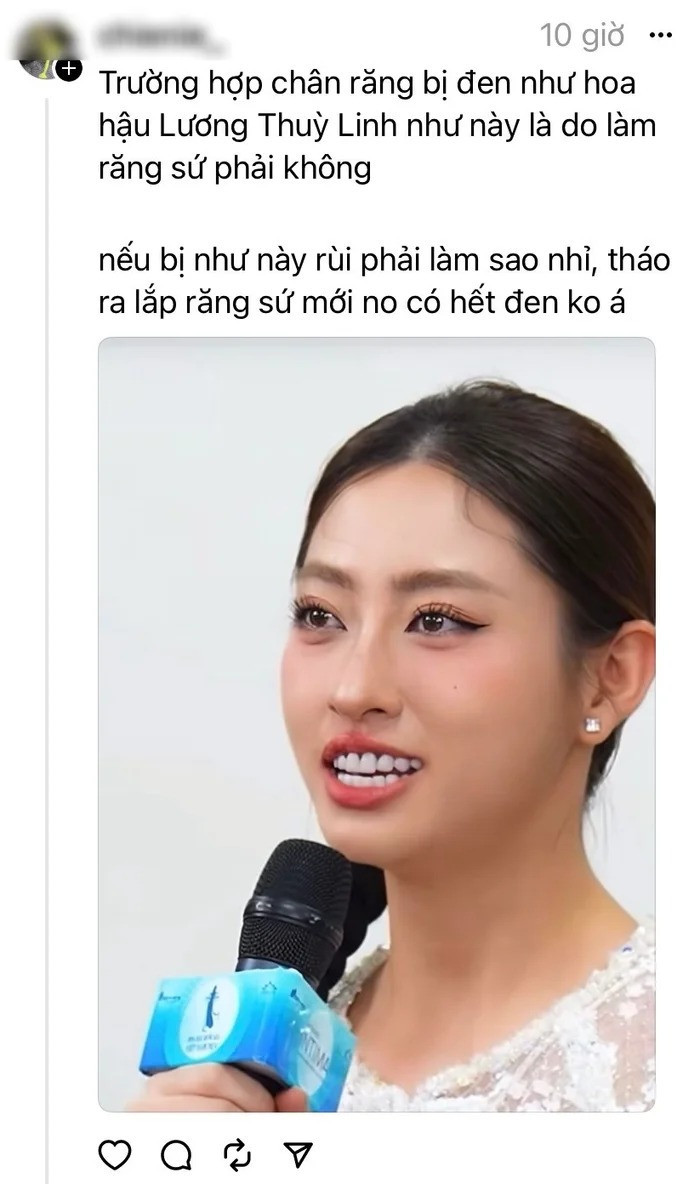 Ảnh cũ để lộ nhan sắc khác lạ vì thẩm mỹ của Lương Thùy Linh netizen tiếc nuối