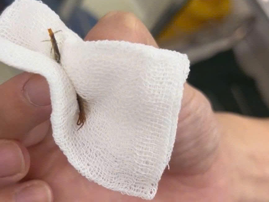 Lấy thành công con rết còn sống, dài 5cm trong tai người đàn ông - Ảnh 1.