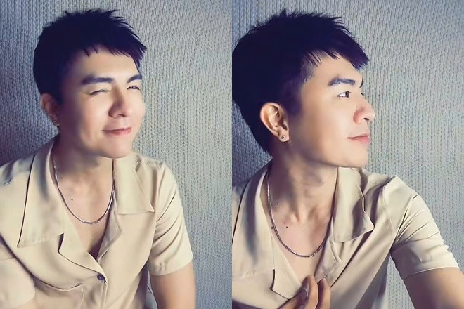 Mỹ nam hot nhất Mưa Đỏ bị nghi phẫu thuật thẩm mỹ để có visual đẹp như Lee Min Ho