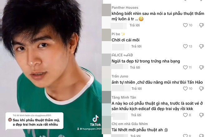 Mỹ nam hot nhất Mưa Đỏ bị nghi phẫu thuật thẩm mỹ để có visual đẹp như Lee Min Ho