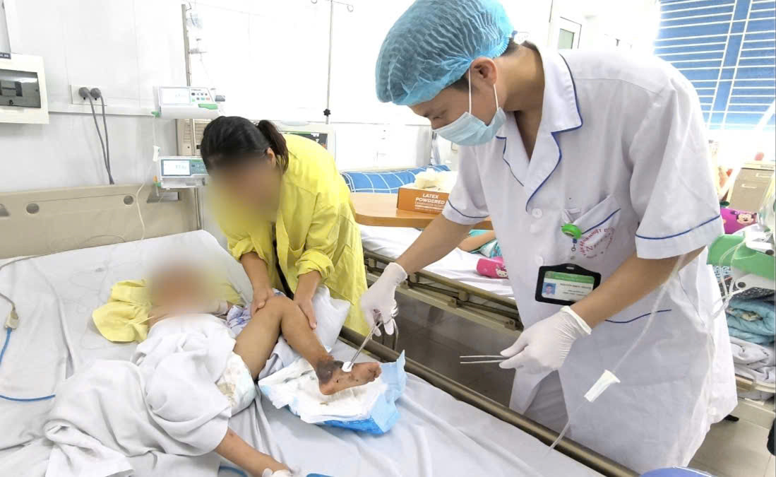 Tự chữa thuốc nam, bé trai 4 tuổi nhập viện vì hoại tử chân - Ảnh 1.