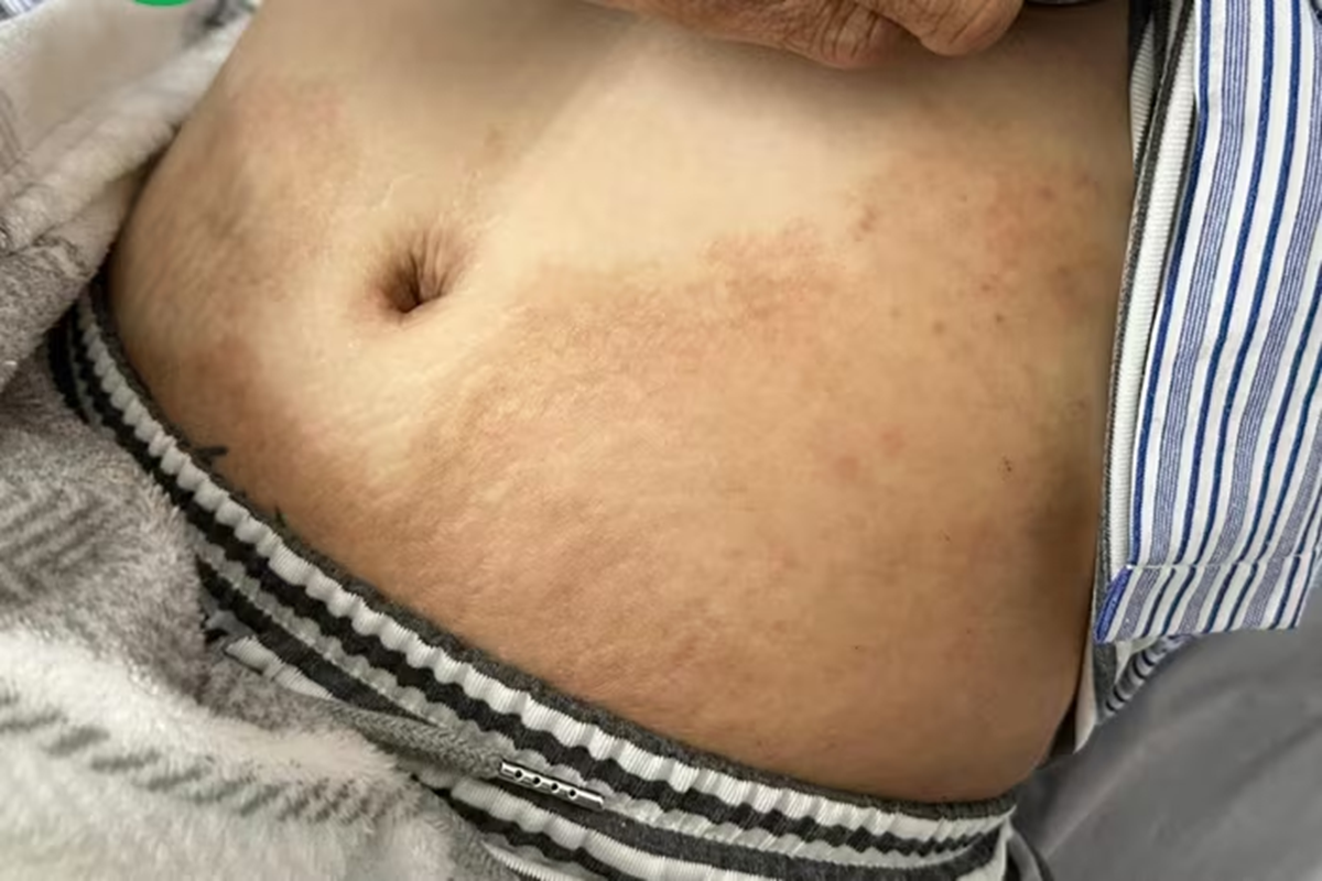 Thường xuyên ăn món