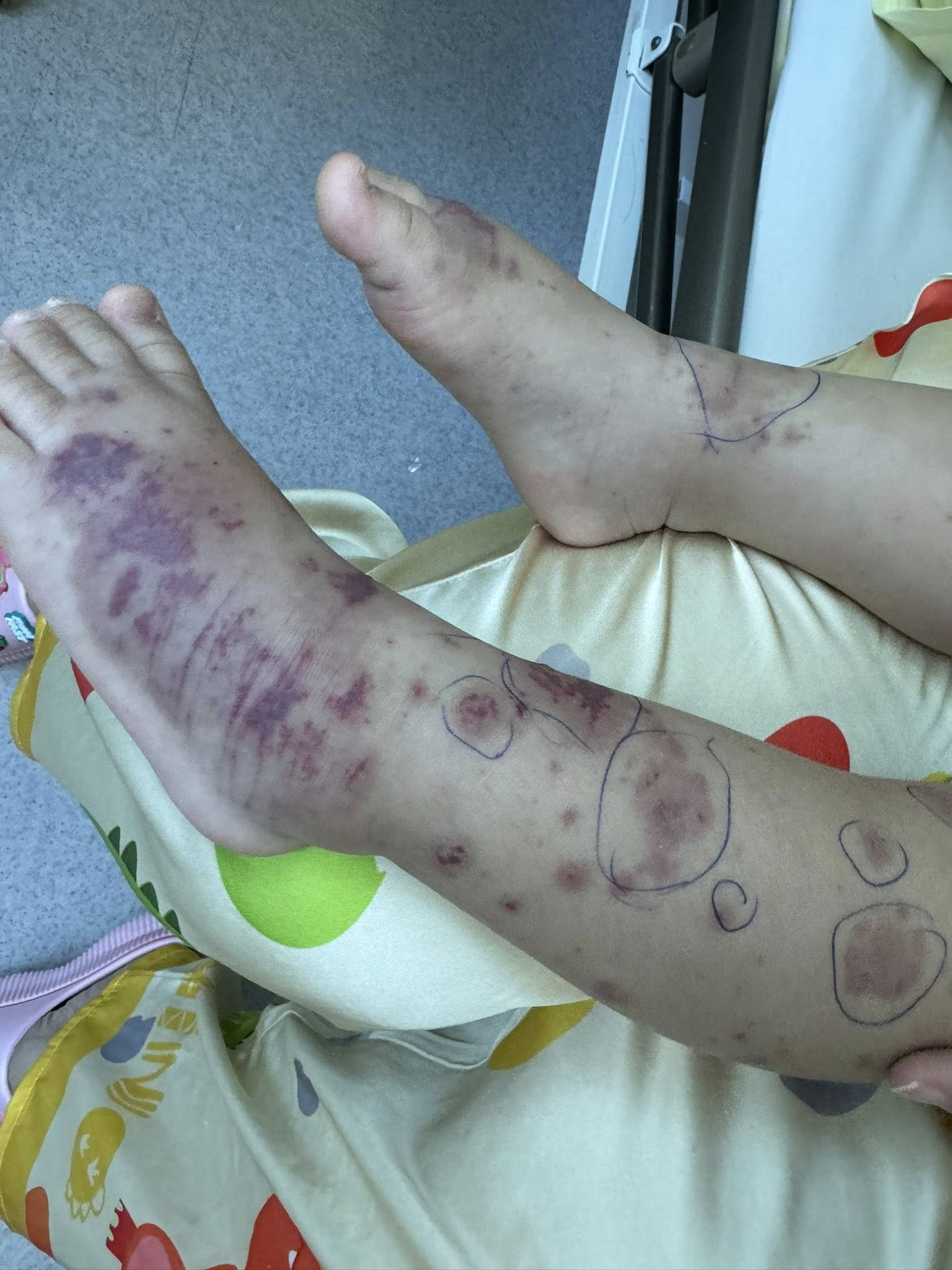 Chuyên gia cảnh báo về một căn bệnh nguy hiểm, lây lan nhanh, tỉ lệ tử vong cao - Ảnh 1.