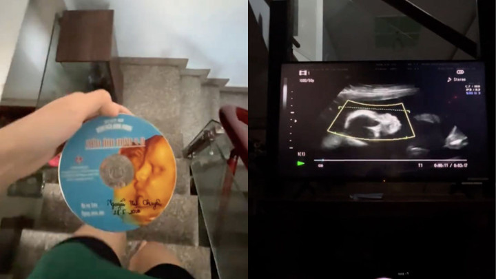 Tác giả nâng niu chiếc đĩa CD ghi hình mình lúc còn trong bụng mẹ. (Ảnh chụp màn hình)