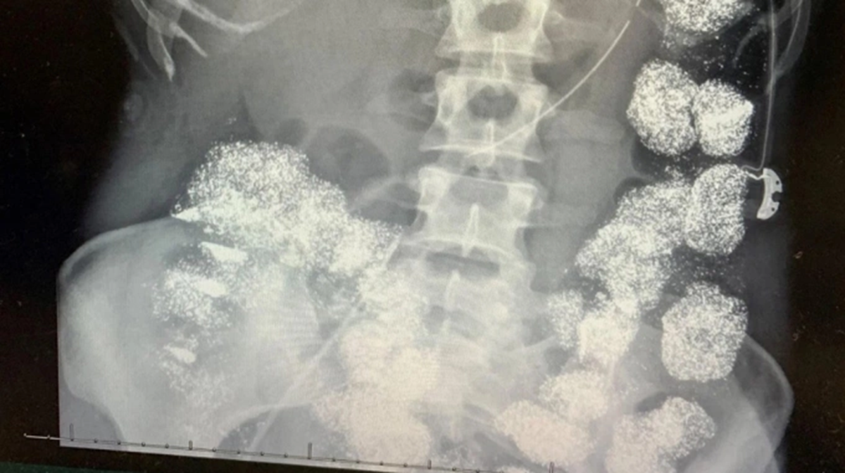 Muốn ly hôn và hưởng bảo hiểm 26 tỷ đồng, người chồng là bác sĩ làm điều không ai ngờ插图1 Muốn ly hôn và hưởng tiền bảo hiểm 26 tỷ đồng, bác sĩ Mỹ đầu độc vợ - Ảnh 2.