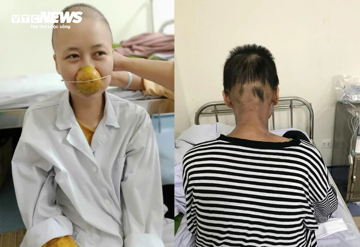 Loan trải qua hành trình chữa ung thư đau đớn, kiên cường.