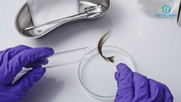 Xét nghiệm ADN khiến chồng nghi vợ ngoại tình, khoa học lại chứng minh người vợ vô tội - Ảnh 1.