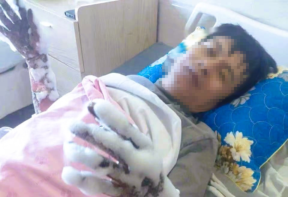 Thanh Hóa thông tin vụ nam công nhân bị điện phóng bỏng nặng 2 tay - Ảnh 1.