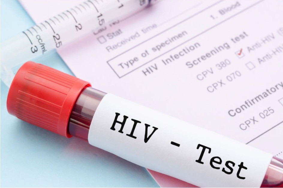 Đi khám vì đau họng, cô gái bất ngờ phát hiện HIV - Ảnh 1.