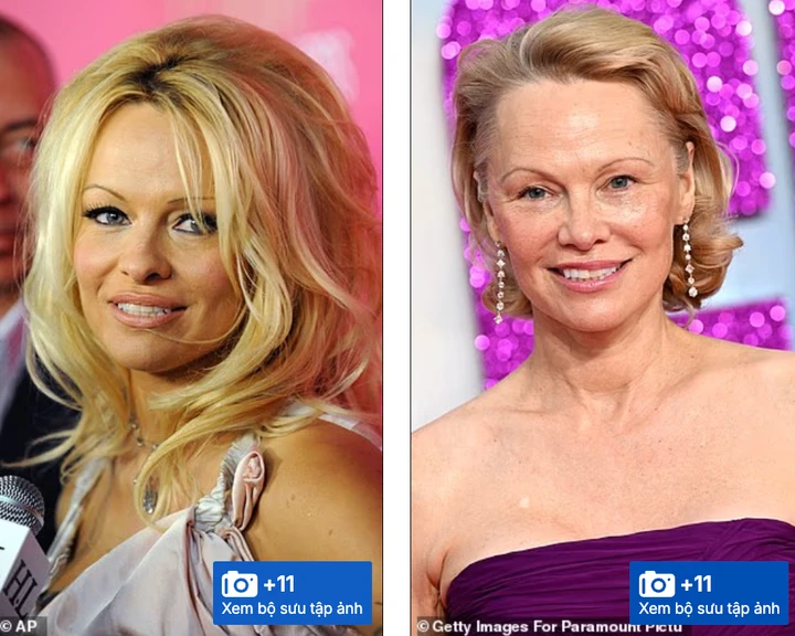 Pamela Anderson (ảnh trái) với lớp trang điểm đậm vào những năm 2000, và vẻ ngoài tươi tắn hơn (ảnh phải) trong những năm gần đây.