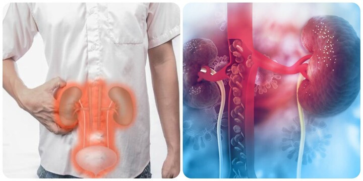 8 thói quen gây suy thận, người Việt cần biết để tránh - Ảnh 3.